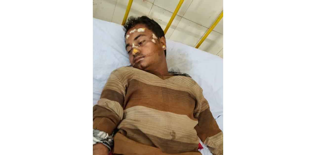 सड़क में  मिले व्यक्ति की नहीं हो पाई है पहचान, बेहोशी के हाल... - CG Sandesh