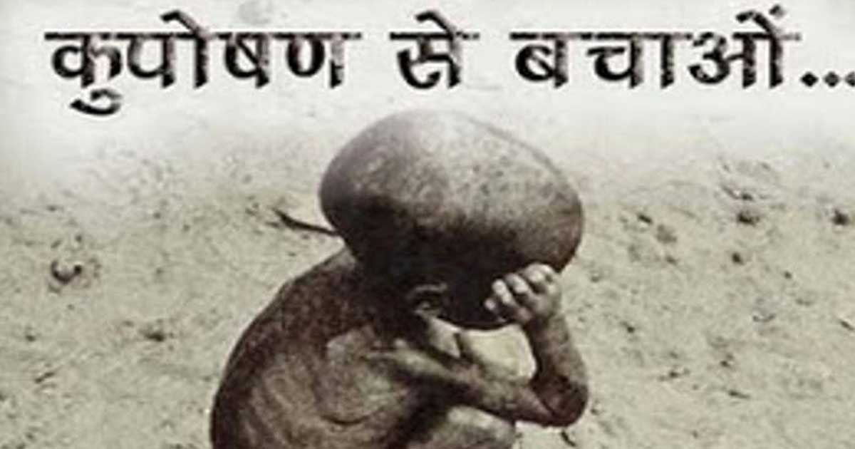 ब्लॉक के आंगनबाड़ी में एक चैथाई बच्चे कुपोषण का शिकार - CG Sandesh