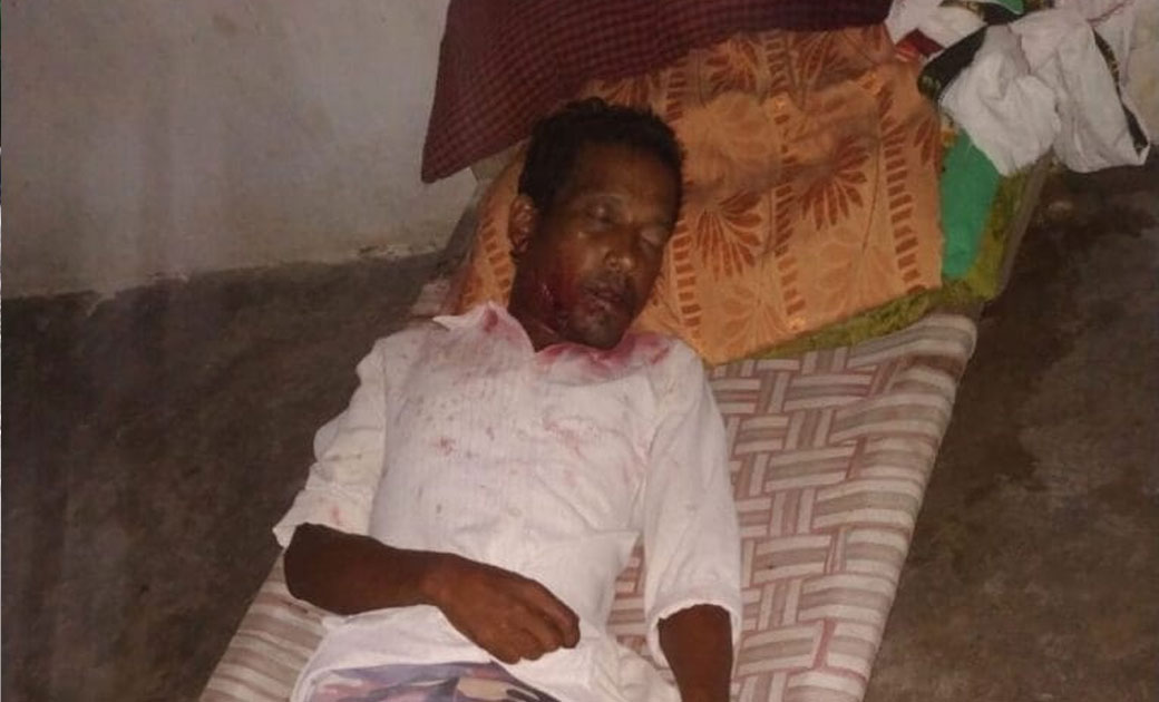 घर मे चल रही थी चिकन दारू की पार्टी..! एक व्यक्ति को परिजन ने ही कुल्हाड़ी मारकर उतारा मौत के घाट....! पुलिस  मौके पर......