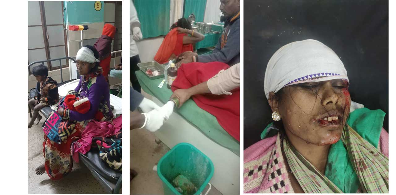 देर रात पलायान से मतदान करने वापस आ रही पिकअप हुई पलटी, महिल... - CG Sandesh
