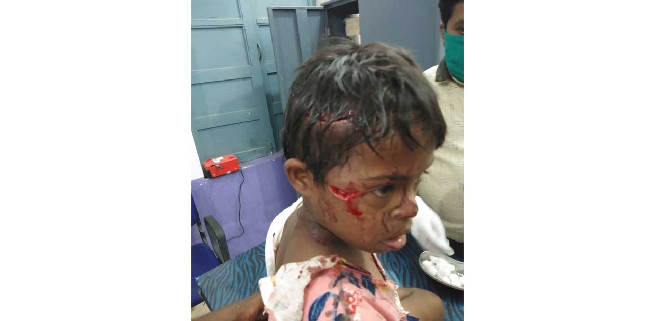 मासूम बच्ची पर तेंदुआ ने किया हमला, पिता ने बचाई जान. तेंदूआ के हमले से लोगों में दहशत का माहौल