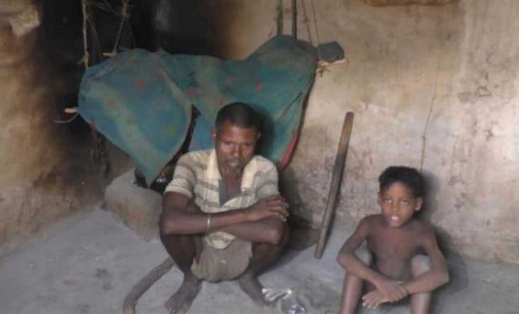 छतीसगढ़:--क्या सच मे कुपोषण और भूखमरी के कारण नहीं हुई है कोडाकू बच्चे की मौत....! बच्चे की मौत के बाद ही सभी कोडाकू परिवार वालों के लिए 2 दिन में राशन कार्ड बनाने का आदेश... सरकारी जांच रिपोर्ट में क्या मिला, पढ़िए पूरी खबर..