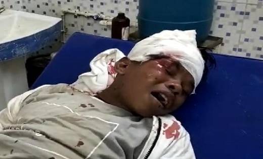सड़क हादसे में घायल हुए ‘बचपन का प्यार’ फेम सहदेव  - CG Sandesh