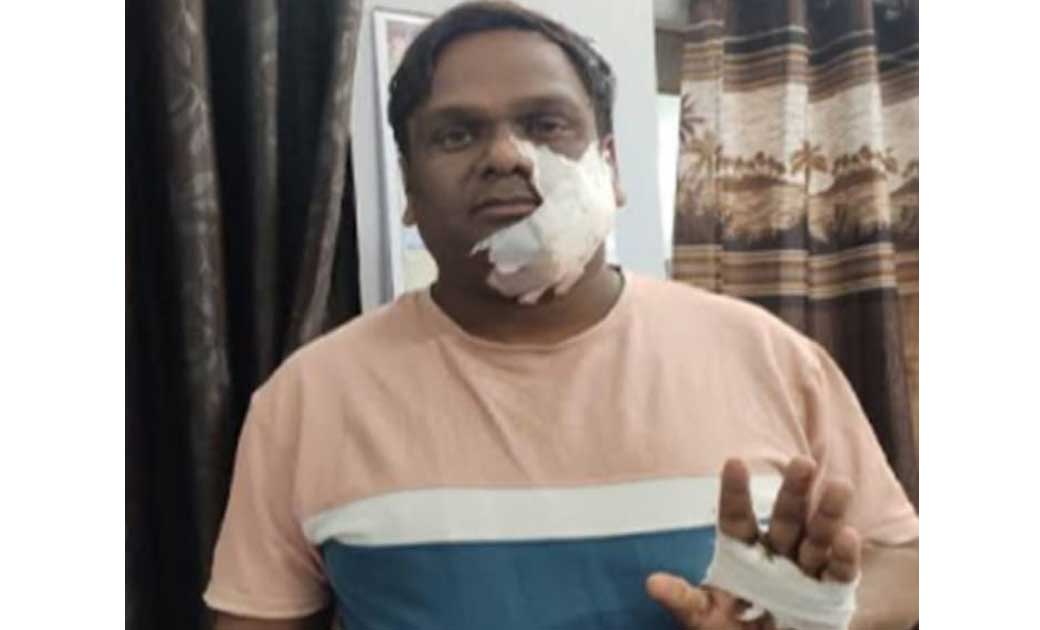 कियोस्क सेंटर संचालक पर दिनदहाड़े चाकू से जानलेवा हमला.. लूट की मंशा या मर्डर का प्लान...!
