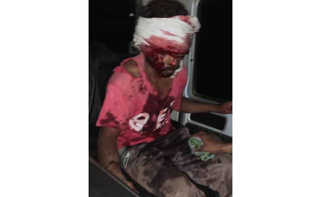 बागबाहरा : आम पेड़ से टकरा कर ट्रक हुआ क्षतिग्रस्, चालक  एंव सहायक गम्भीर रूप से घायल