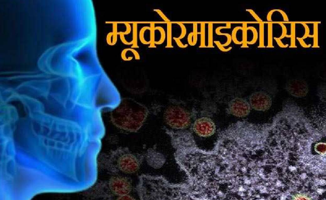 देश में ब्लैक फंगस का प्रकोप, इन 13 राज्यों में जानलेवा बीमा... - CG Sandesh