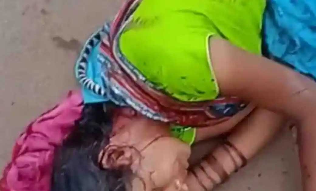 खानदानी जमीन को लेकर महिला के सिर में कुल्हाड़ी से हमला,  बुरी तरह  हुई घायल