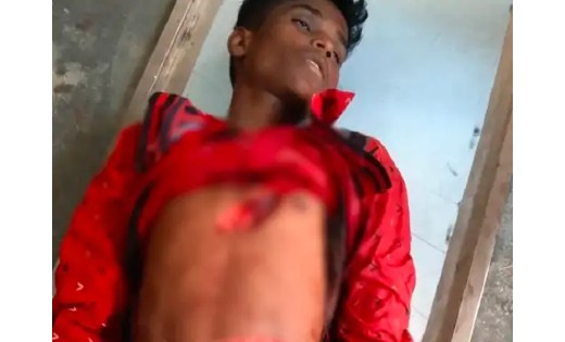 स्टील के गिलास में फोड़ा बम, सीने में घुसा गिलास का टुकड़ा, ना... - CG Sandesh
