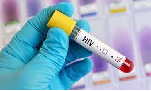 जेल में 140 कैदी HIV पॉजिटिव पाए गए, स्वास्थ्य विभाग में हड़... - CG Sandesh