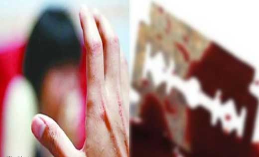 बागबाहरा : पत्रकार पर कबाड़ी वाले ने ब्लेड से किया हमला. - CG Sandesh