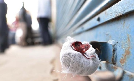 पीडीएस के चना एवं गुड़ का अवैध क्रय एवं भण्डारण, गोदाम सील - CG Sandesh