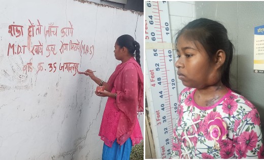 टीबी, कुष्ठ सर्वे में 9.17 लाख लोगों की हुई स्क्रीनिंग - CG Sandesh