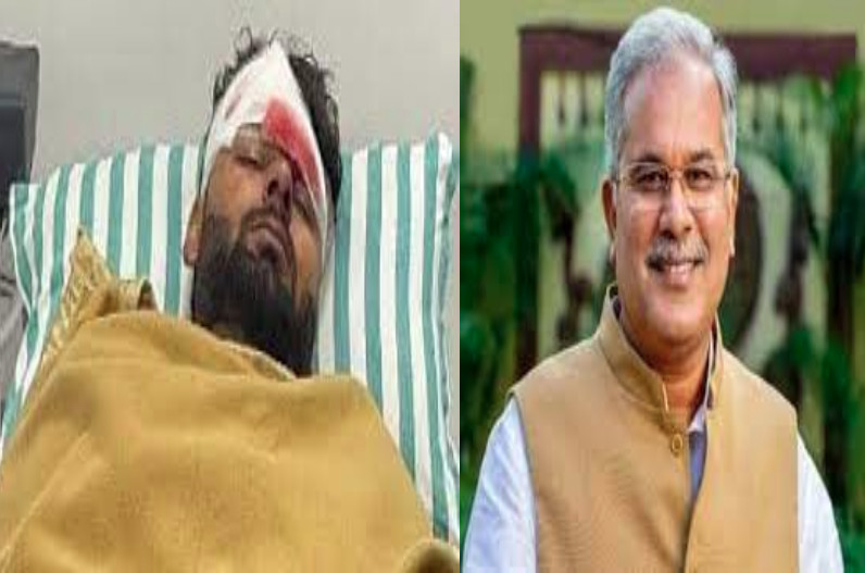 सीएम ने की जल्द स्वास्थ्य होने की कामना , भीषण सड़क हादसे का ... - CG Sandesh