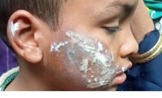  खाना मांगने पर कलयुगी मां ने मासूम बच्चे को गर्म प्रेस से ज... - CG Sandesh