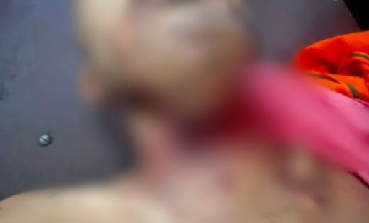 CG NEWS : बीमारी से परेशान युवक ने की आत्महत्या, सर्जिकल ब्ल... - CG Sandesh