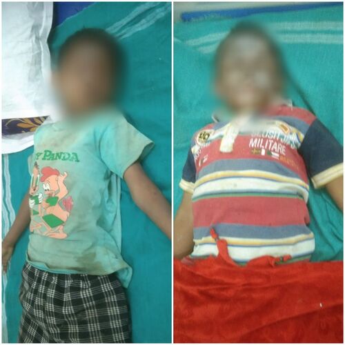 पटाखे की चपेट में आने से दो बालक झूलसे,  जिला अस्पताल में इल... - CG Sandesh