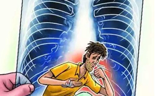 प्रदेश में टी बी के अति संवेदनशील समूह का होगा मानचित्रण  - CG Sandesh