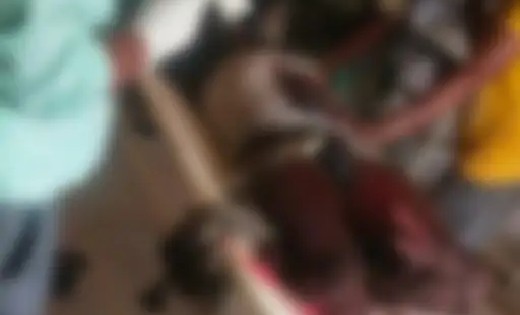 CG : IED ब्लास्ट की चपेट में आया CAF का एक जवान, दोनों पैरों... - CG Sandesh