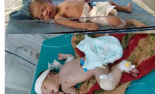 चूहों ने नवजात के अंगों को कुतरा, बच्चे को देख मां के उड़े ह... - CG Sandesh