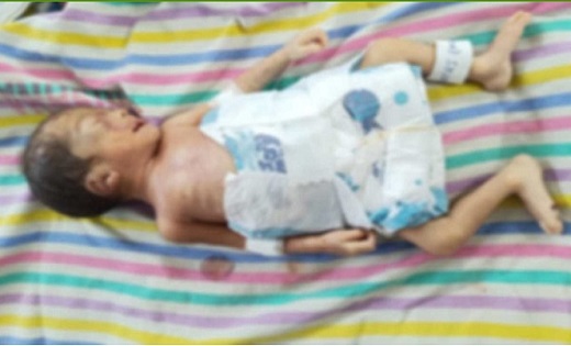 शहर के कचरा संग्रहण स्थल के पास जिंदा नवजात बच्चा मिलने से इ... - CG Sandesh
