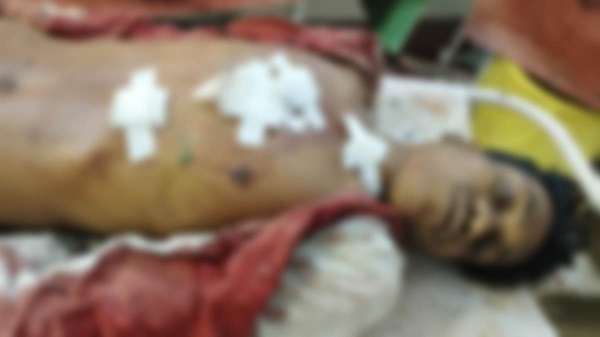 CRIME : मां के सामने बेटों पर जानलेवा हमला, एक की मौत; दूसरा... - CG Sandesh