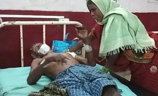 तेंदूपत्ता तोड़ने जंगल गए ग्रामीण पर भालुओं ने किया हमला, गं... - CG Sandesh