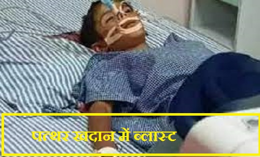 CG : 8 साल की मासूम घायल...पत्थर खदान में ब्लास्ट - CG Sandesh