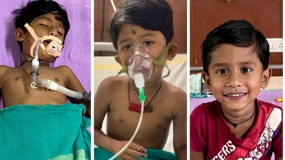 CG : सांप के डसने से मासूम का शरीर हो रहा था लकवाग्रस्त, 42 ... - CG Sandesh