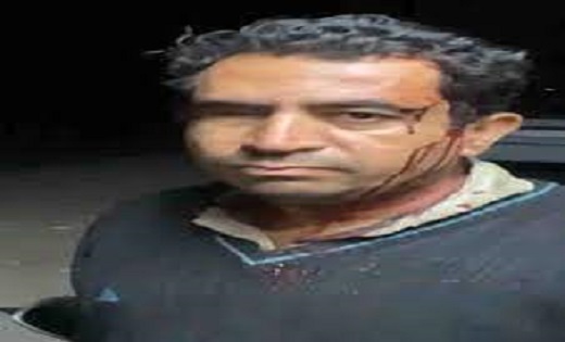 राजधानी में लुटेरों के हौसले बुलंद, कमल विहार में कारोबारी से लूट की कोशिश