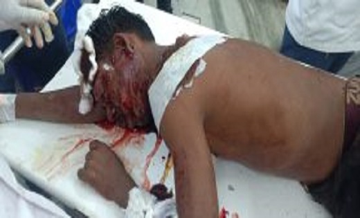 राहगीर बने मददगार, भालू के हमले से गंभीर रूप से घायल युवक का... - CG Sandesh