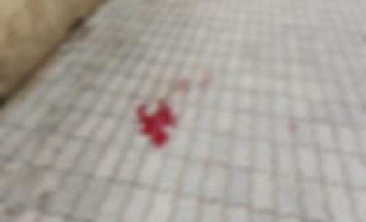 राजधानी के एक अस्पताल की 5 वीं मंजिल से कूदा मरीज, सिर पर चोट लगने से मौके पर ही मौत