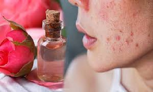 Rose Water For Skin: हफ्तेभर में चमक जाएगी आपकी स्किन! मानसू... - CG Sandesh