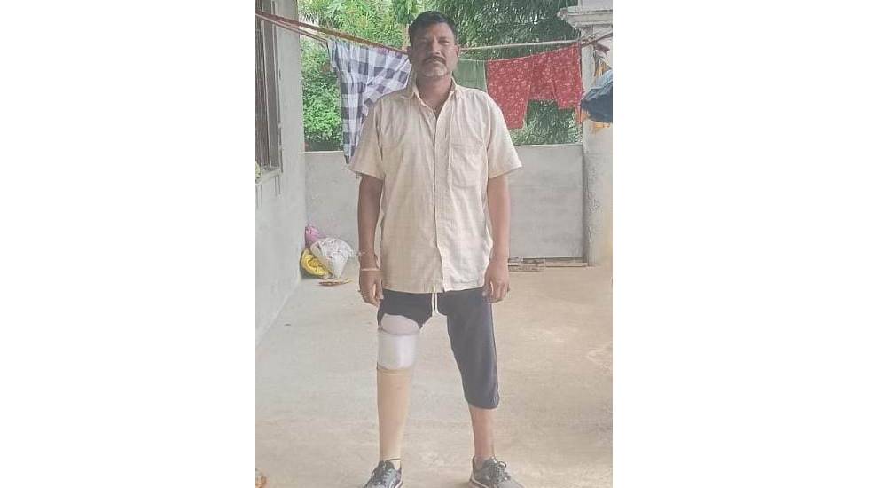 मुख्यमंत्री साय की पहल पर सड़क दुर्घटना में एक पैर गंवा चुके ... - CG Sandesh