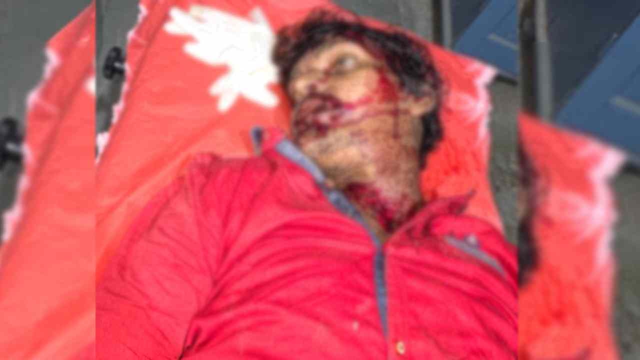 बसना : अज्ञात वाहन ने युवक को रात में पीछे से रौंदा, सिर में... - CG Sandesh