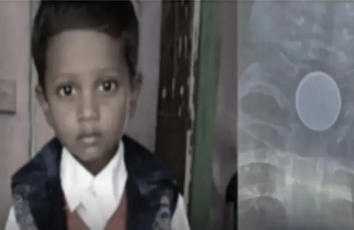 CG : 8 साल के मासूम के सीने में फसा सिक्का, हुई मौत  - CG Sandesh