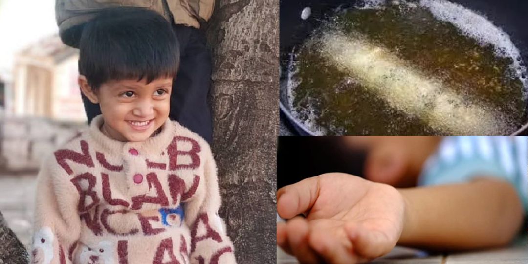 खेलते-खेलते गर्म तेल की कढ़ाई में गिरा 2 साल का मासूम, हुई दर... - CG Sandesh