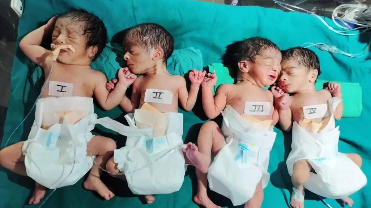 CG : महिला ने 7 महीने में ही एक साथ चार बच्चों को दिया जन्म, खूब हो रही चर्चा