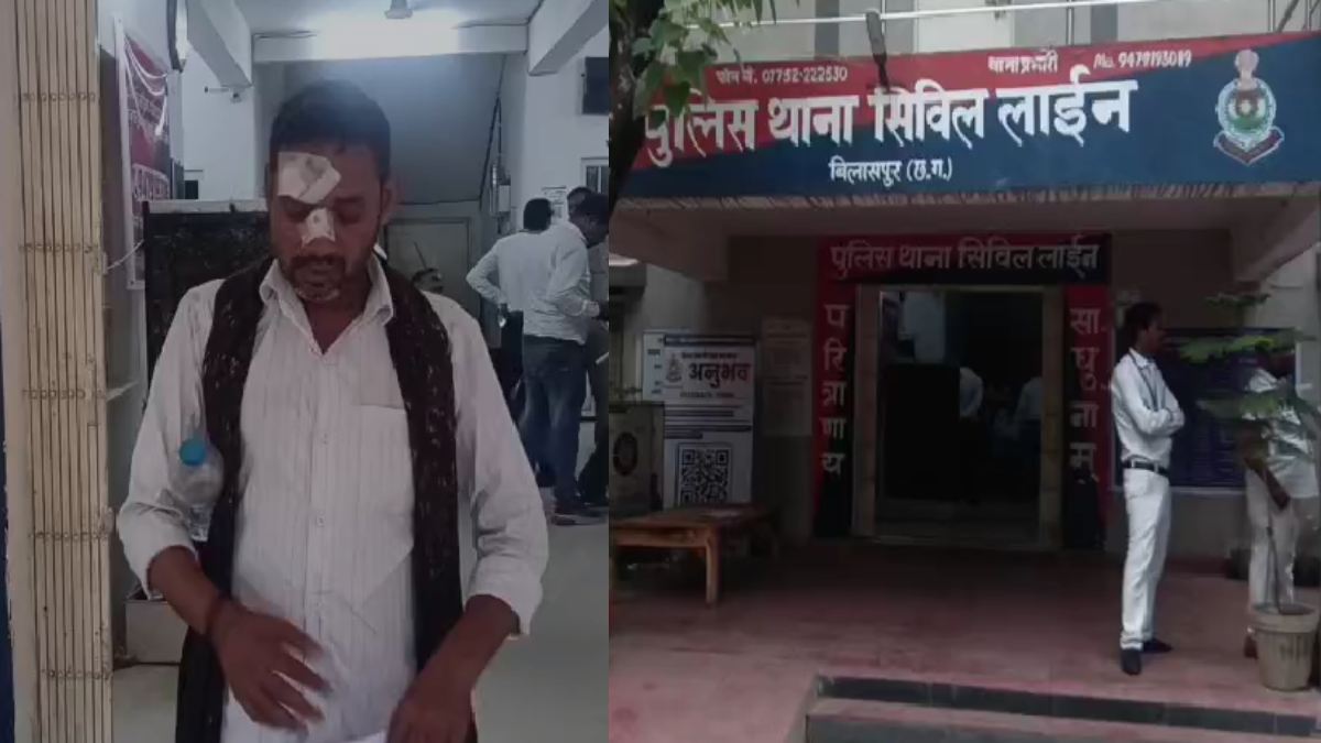बिलासपुर : पैसे मांगने पर चाय दुकानदार पर धारदार वस्तु से हम... - CG Sandesh