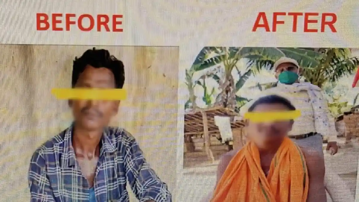 महासमुंद : शरीर पर सफेद या सुन्न चकत्ते, सुन्नपन अथवा पलक बंद न होने जैसे लक्षण दिखने पर  नजदीकी स्वास्थ्य केंद्र में जांच कराने की अपील